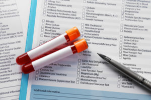 how to measure neurotransmitter levels