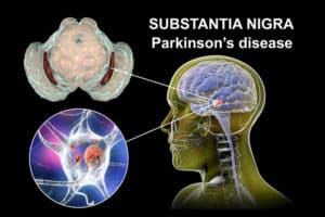 natural treatment for parkinsons